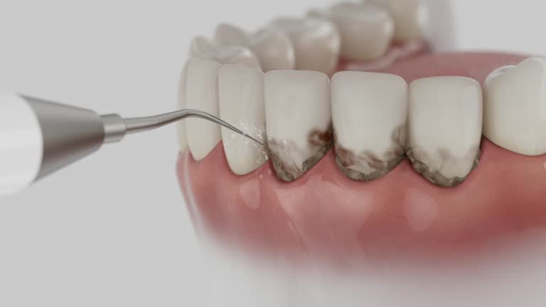 Reliable Tooth Extraction contractor in Miller County County, MO by Dentist Open Now